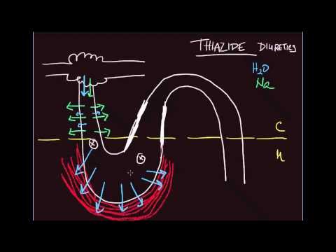 10-minute Rounds:  Diuretic-induced hyponatremia (Effect of thiazide diuretics on Na+ concentration)