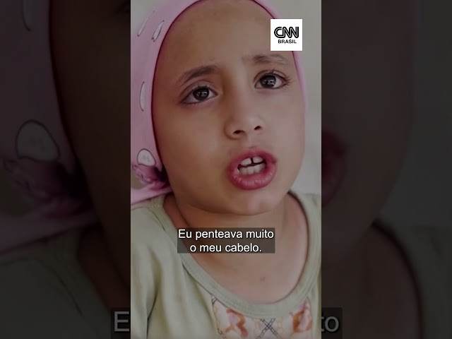 Criança em Gaza tem queda de cabelo por choque nervoso | CNN Brasil