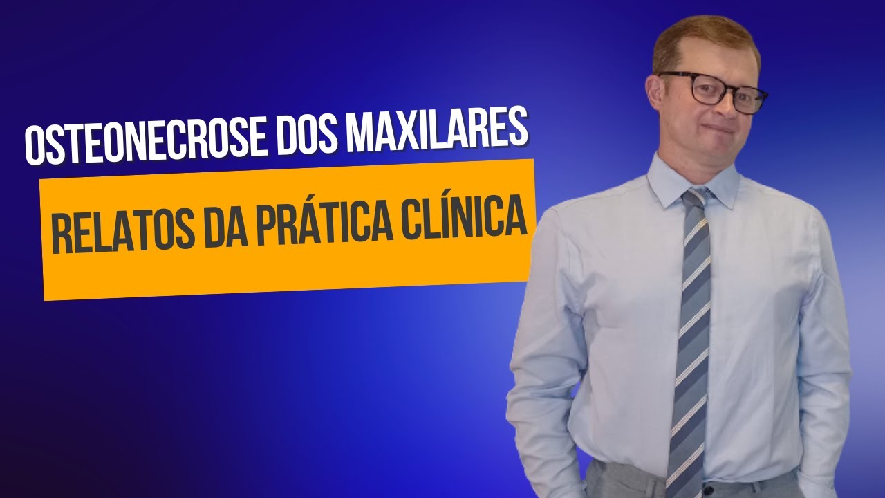 Osteonecrose dos maxilares, Relatos da prática clínica | Prof Mauricio Volkweis