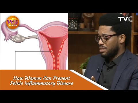 What Women Should Know About Pelvic Inflammatory Disease