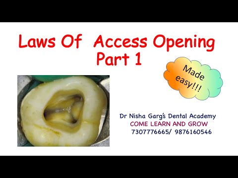 Laws Of Access Cavity Preparation - Part 1