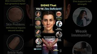12 Signs of Zinc Deficiency You Should Never Ignore