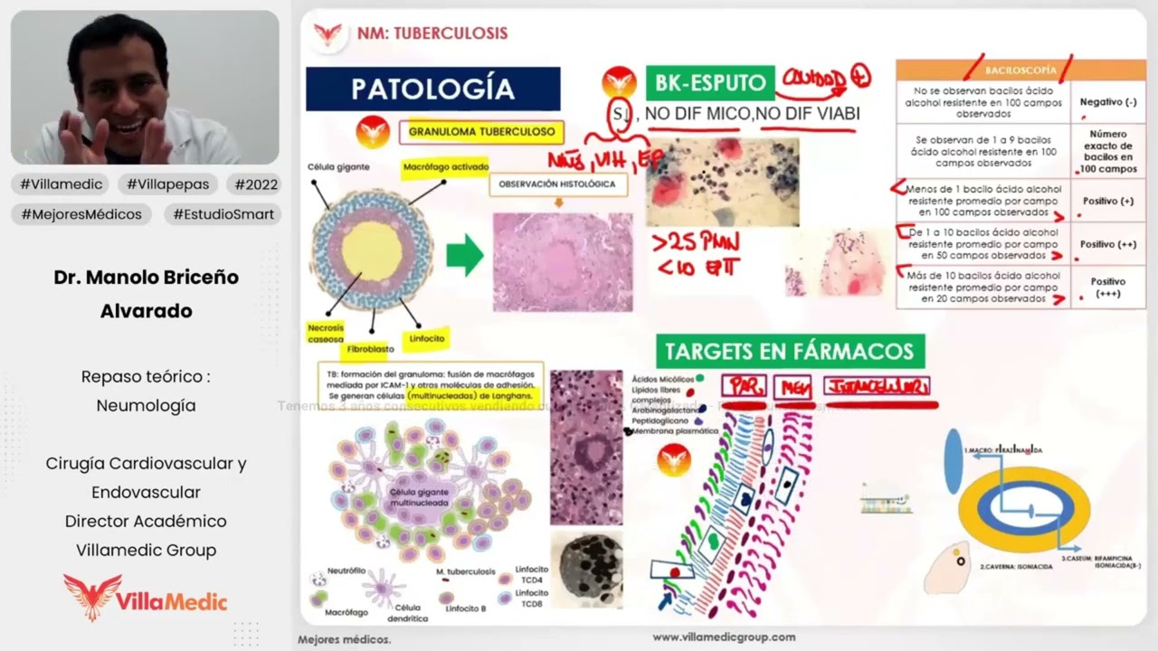 TUBERCULOSIS PULMONAR - NEUMOLOGÍA - VILLAMEDIC