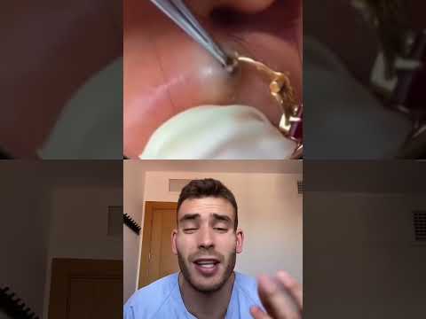 You can pass #shorts