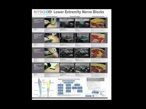 NYSORA TEACHING POSTERS IN SITU