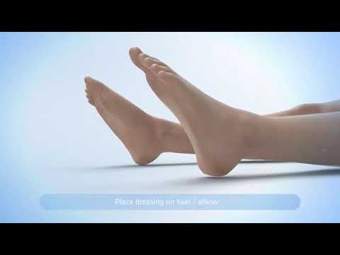 Application KERRAMAX CARE Super Absorbent Dressing 3M KCI