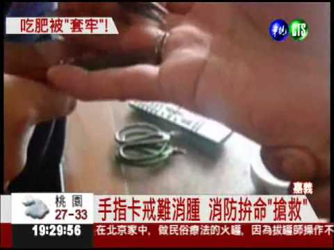 暑假變胖手變粗 戒指"卡卡"頻傳!