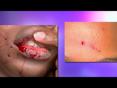 Breaking Free: Transgender people are nearly twice as likely to experience intimate partner viol...