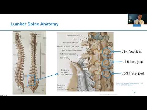 Image - Where Does Back Pain Come From?