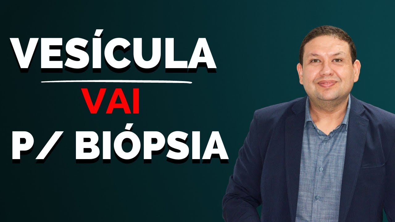 CIRURGIA DE PEDRA NA VESÍCULA - Porquê a vesícula vai para biópisa depois da cirurgia de vesícula?