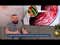 Gastrita Boala Stomacului Care Ne Poate Afecta Grav Dr Ovidiu Peneș Despre Factorii De Risc