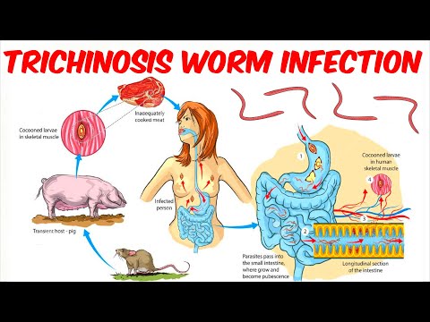Betegségek által okozott pinworm helminták