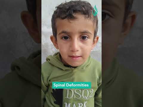 Support Ali to Overcome His Difficulties