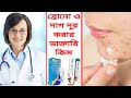According To Doctors Know The Names Of The 7 Best Creams To Get Fair Skin By Removing Acne And A