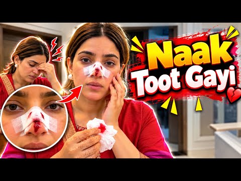 Naak Toot Gayi? 😱 | Daily Vlogging | Rabia Amir