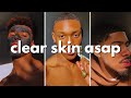 How To Get Clear Skin For Guys Asap No Bs Guide