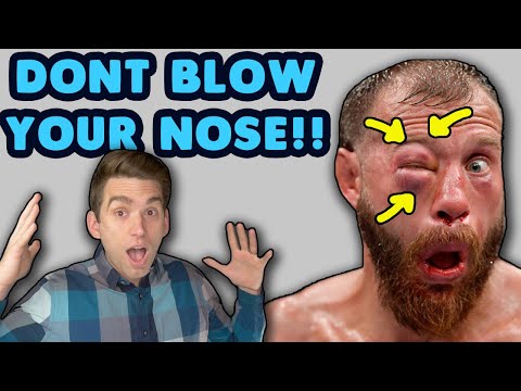 Doctor REACTS to Donald Cerrone EYE SWOLLEN After He Blows Nose at UFC 238