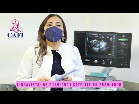Ultrasonido Transvaginal