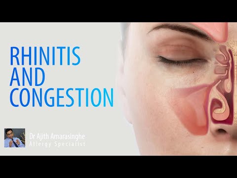 Rhinitis and Congestion | Allergy And Asthma Centre