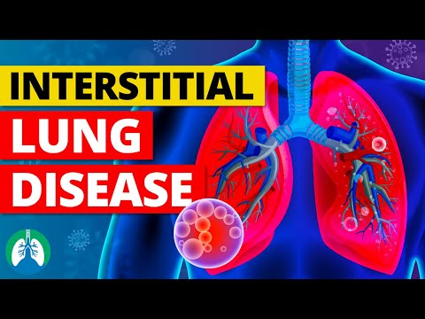 Interstitial Lung Disease (Medical Definition) | Quick Explainer Video