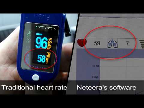 Neteera  Contact Free Vital Signs monitor  161212