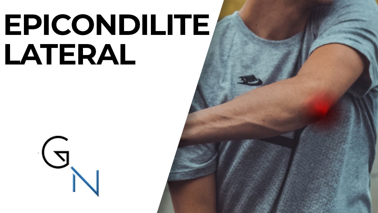 DOR NO COTOVELO? EPICONDILITE LATERAL - O que é, causas, sintomas e tratamentos