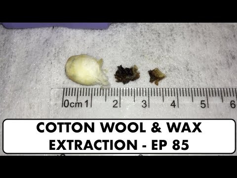 COTTON WOOL & EAR WAX REMOVAL - EP 85