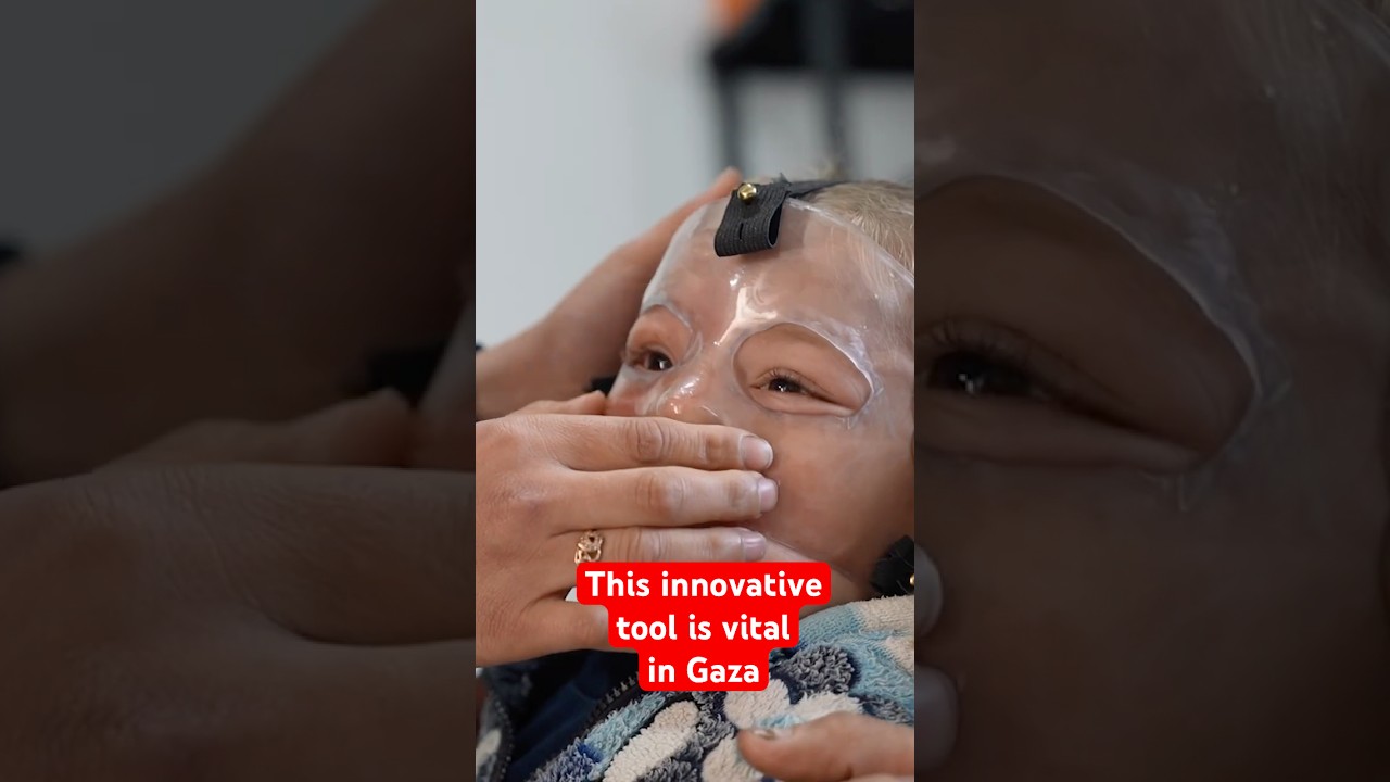 3D-printed physiotherapy masks in Gaza