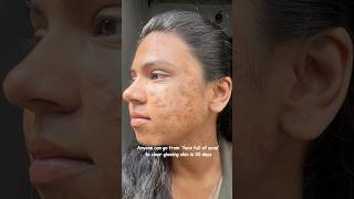 Say Goodbye to Tiny Bumps ✨ | Smooth, Glowing Skin Routine 💖 #Shorts