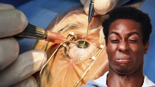 5 Curiosidades sobre o Formato dos Olhos Asiáticos que Você Nunca Soube!