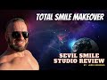 Sevil Smile Studio review - honest, raw and unedited thoughts. Antalya, Turkey.