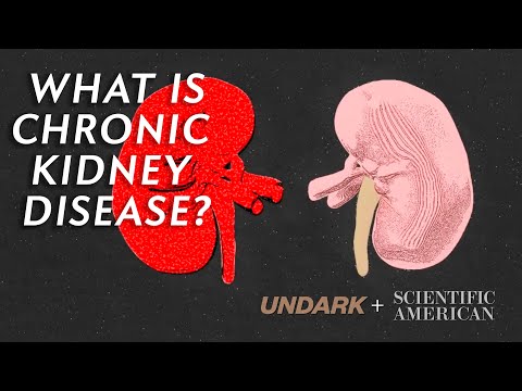 What is Chronic Kidney Disease and how does dialysis work?