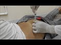 Im Injection Buttock How To Give An IM Intramuscular Injection Ventrogluteal Buttock Muscle