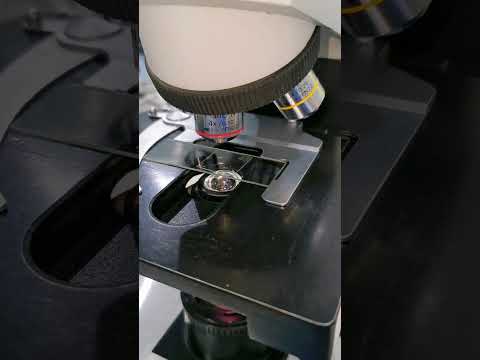 Dandruff under the microscope #laboratory #microscope #dandruff #underthemicroscope