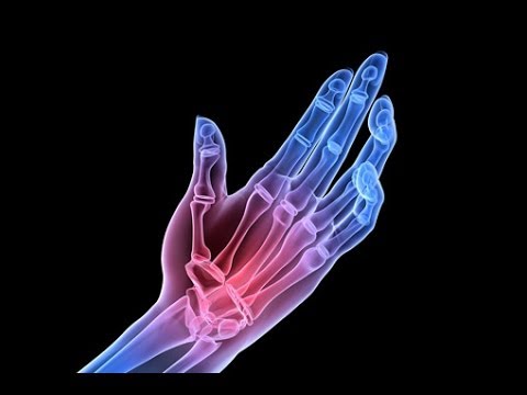 Sintomi del mal di schiena e addome inferiore nelle donne Combilipen cliente osteocondrosi