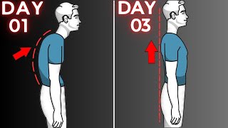 How to Fix Rounded Shoulders (GONE IN 5 Exercise!)