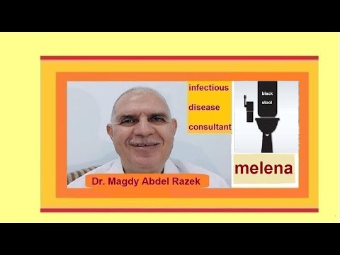 melena | black stool