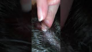 Skin Picking Insanity: So Many Scabs, So Little Time.