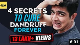 How To Remove Dandruff From Hair Permanently at Home | BeerBiceps |  4 Secrets 2021 Tips