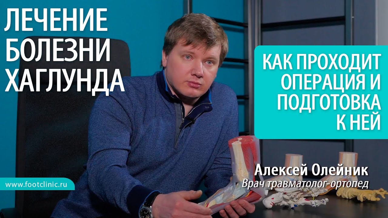 Обзор способов удаления шишек на пальцах ног