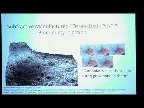 Dr. Anton Thompkins Explains ILIF (Interlaminar Lumbar Instrumented Fusion) and Interbody Fusion