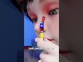 Lego Stuck In Nose For 26 Years
