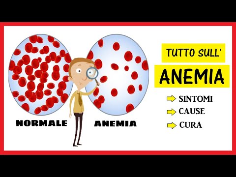 , title : 'L'Anemia: cos'è? Quali sono i sintomi, le cause e come si cura?'