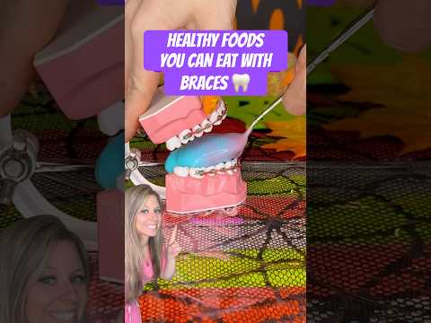 4 HEALTHY SNACKS THAT ARE SAFE FOR BRACES 🦷 #braces #food #foodasmr