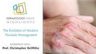psoriasis pronunciation