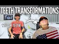 ALL 4 WISDOM TEETH OUT Ty S Surgery Day BIG Braces Update For Hallie Life As We Gomez
