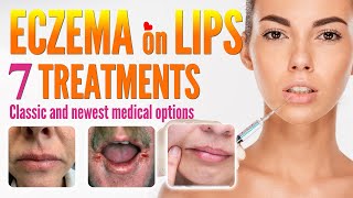 Eczema on Lips Treatment Options | How to Treat Lip Eczema Around Mouth Dermatitis