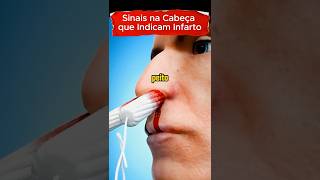 SINAIS NA CABEÇA QUE INDICAM INFARTO #saude #saudavel #infarto #coração #cabeca