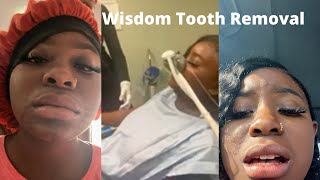 Wisdom Tooth Removal! Very Funny Must Watch