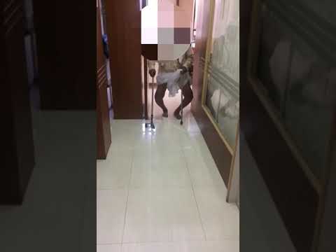 severe Varus Pre opt Patient